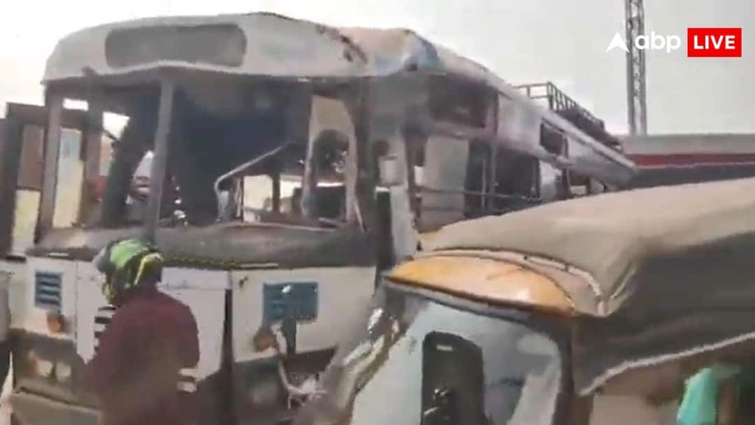 संगारेड्डी के सदाशिवपेट में NH-65 पर आरटीसी बस-लॉरी की जोरदार टक्कर, 15 यात्री गंभीर घायल