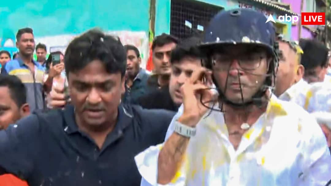 हमले में अभिषेक बनर्जी को नहीं आई कोई गंभीर चोट, चेकअप करने वाले डॉक्टर ने अपनी एमएलसी रिपोर्ट में क्या बताया?